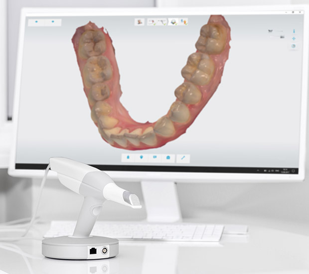Santa Ana 3D Cone Beam and 3D Dental Scans