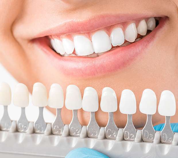 Visit Our Dentist Office In Santa Ana For A Smile Makeover